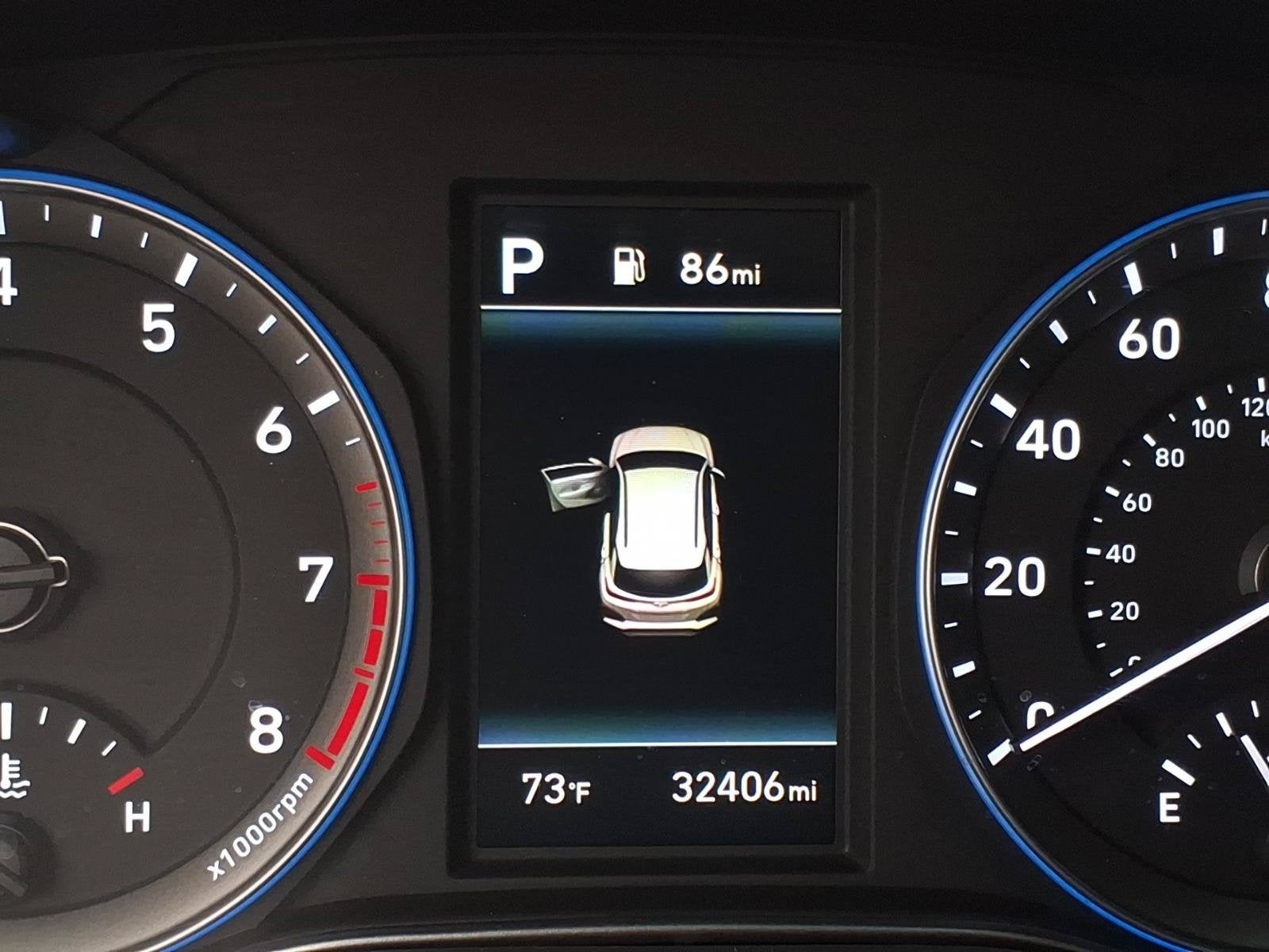 2021 Hyundai Kona Ultimate